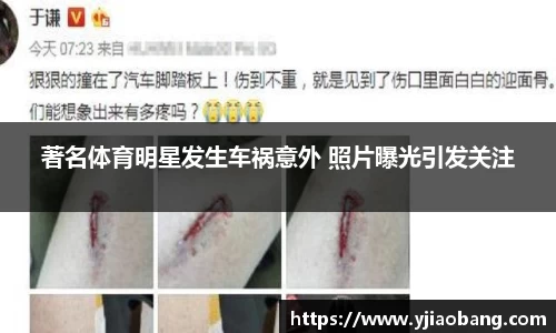 著名体育明星发生车祸意外 照片曝光引发关注
